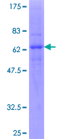 12.5% SDS-PAGE Stained with Coomassie Blue.
